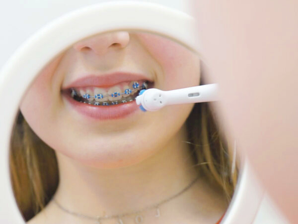 Orthodontie bij Dentl